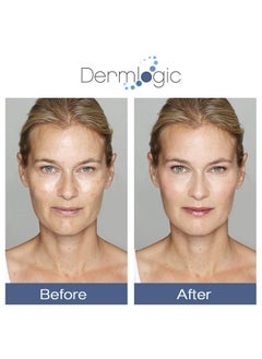 Dermlogic Glycolic Cream 15% Natural Anti Aging Exfoliator To Smooth Away Fine Lines & Wrinkles & Improve A Dull Looking Complexion. Includes A.H.A & Green Tea Moisturizer For Face & Body.  - Image 5