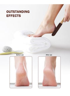 BEZOX Foot Pumice Stone Pedicure File(1 Pcs) - Ergonomic Wooden Handle Foot File Callus Remover For Smoother Feet And Hands - Foot Scrubber, Heel Sander And Dead Skin Scraper - Brown  - Image 2