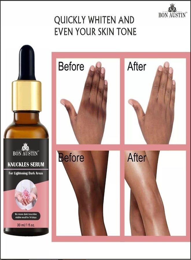 Bon Austin Knuckle Skin Serum for Lightening Dark Areas 30ml with Free 1 Pc Apple Shape Red Lipstick - Image 3