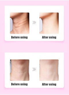Prime by javaudan Face Massager Beauty Machine Neck Lifting Device Anti Wrinkle Remover Fine Lines  - Image 5