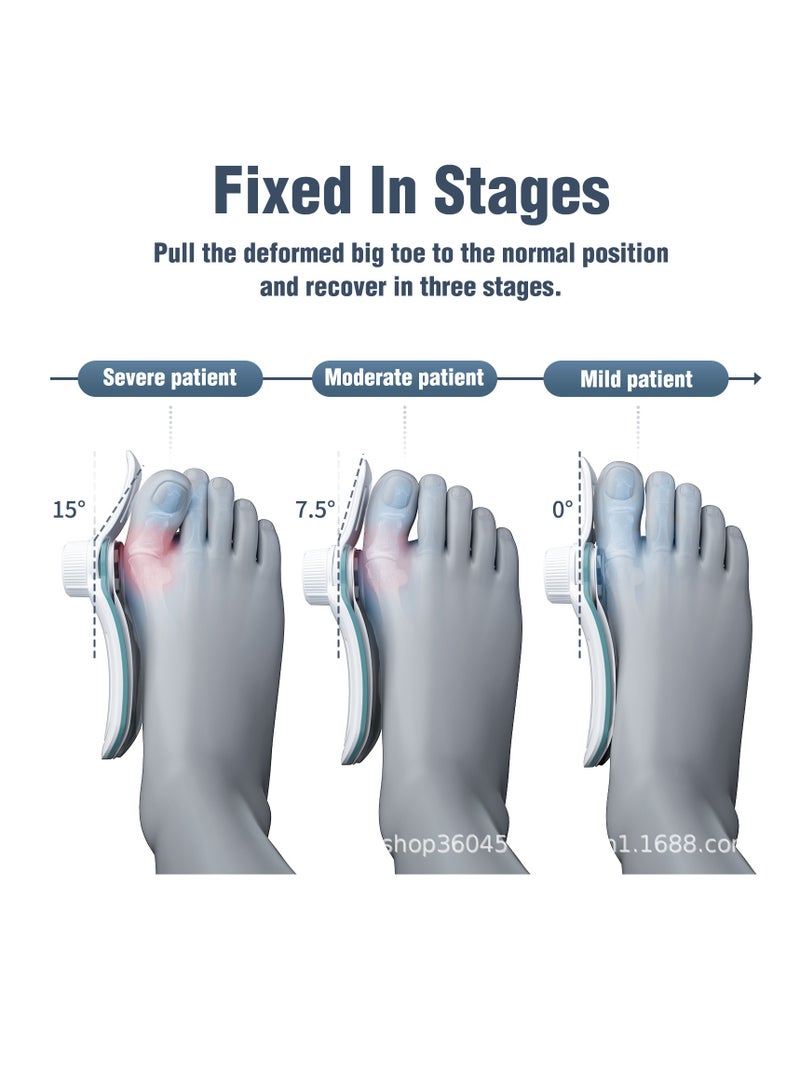 general Foot Care Bunion Corrector Hallux Valgus Orthotics Big Toe Toe Homing Linters Adjustable Bunion Pads with 3 Angles Fixing Plate - Image 2