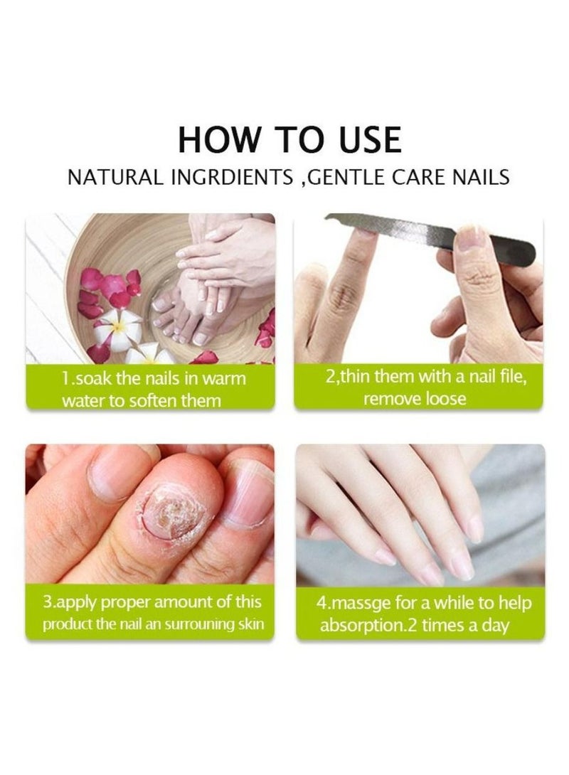 efero Nail Treatment and Repair Gel Instant Repair and Heal Nail Quickly 20g - Image 4