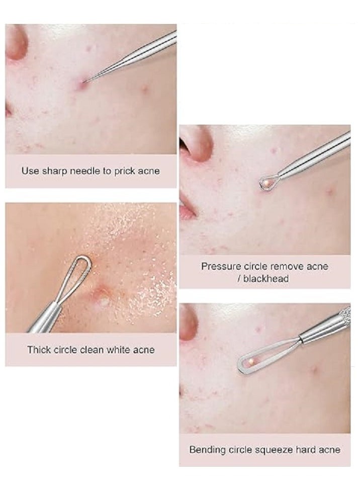 Nascita Blackhead And Pimple Removal Kit  - Image 4