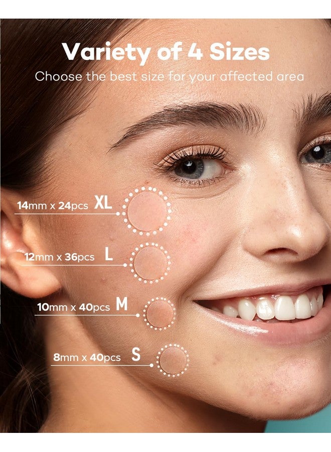 TKTK Acne Patch Pimple Patch, 4 Sizes 140 Patches Acne Absorbing Cover Patch, Hydrocolloid Invisible Acne Patches For Face Zit Patch Acne Dots Tea Tree, Calendula Oil - Image 1