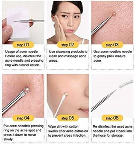 Elecsera 4Pcs Blackhead Pimple Golden Remover Tools for Face Professional Extractor Tweezers Kit Pack of 4 - Image 4
