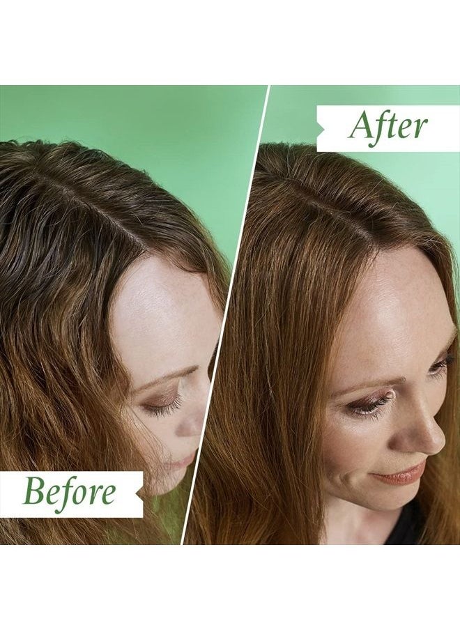 Philip Kingsley - Flaky Scalp Shampoo for Flaky Dry, Oily Scalps Cleansing Scalp Care Hair Products Soothing, Soothes and Calms, 8.45 oz. - Image 1