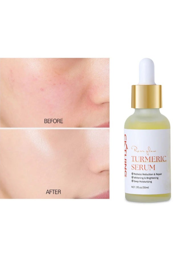 CKTUING Turmeric Serum for Dark Spots 1 Fl Oz, Turmeric Dark Spot Corrector Serum for Face & Body, Anti Aging Facial Serum, Reduces Hyperpigmentation, Age Spots, Sun Spot, Improve Skin Tone - Image 2