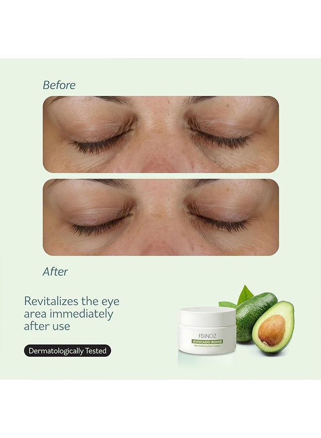 Hoygi Avocado Bomb Revitalizing Eye Cream, Moisturizing & Elastic Formula for Dark Circles, Puffiness, Anti-Wrinkle, Firming & Lifting, Reduces Fine Lines for Youthful, Bright Eyes - Image 3