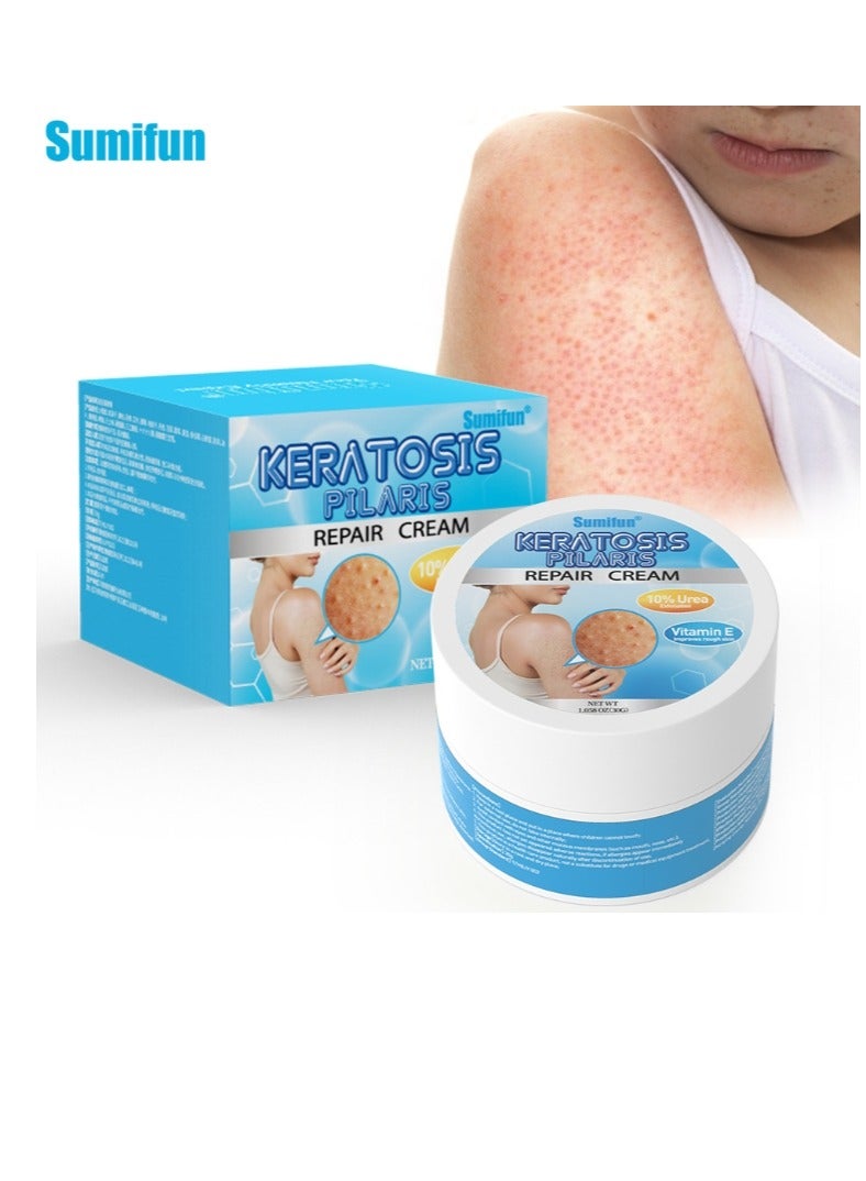 سوميفون لوشن تنظيف التقرن الشعري، مزيل جلد الدجاج، مرطب للبشرة وإصلاح حب الشباب، كريم منعش للجسم، سريع المفعول، استعادة غسول الجسم للاستخدام اليومي والليلي، 30 جم - Image 1