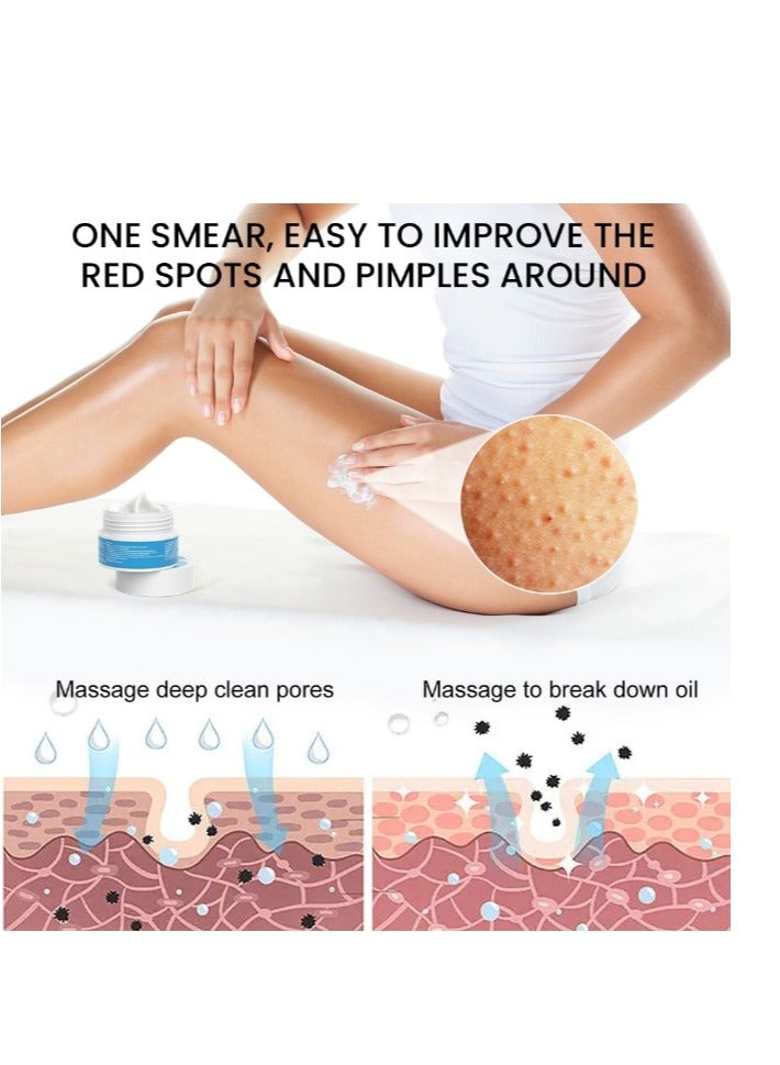 سوميفون لوشن تنظيف التقرن الشعري، مزيل جلد الدجاج، مرطب للبشرة وإصلاح حب الشباب، كريم منعش للجسم، سريع المفعول، استعادة غسول الجسم للاستخدام اليومي والليلي، 30 جم - Image 2