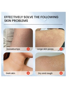 Sumifun Cleansing Keratosis Pilaris Lotion Chicken Skin Removal Skin Moisturizer And Acne Repair Body Refreshing Cream Fast Effective Relief Restoring Body Lotion for Daily and Night Body Use 30G  - Image 3