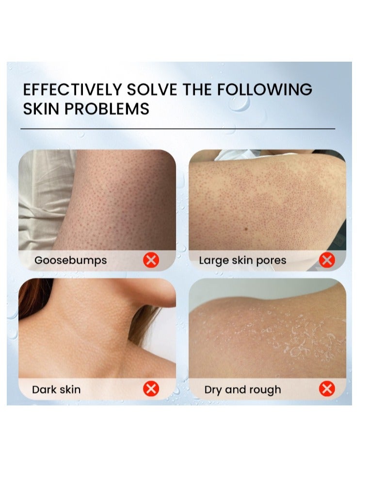 سوميفون لوشن تنظيف التقرن الشعري، مزيل جلد الدجاج، مرطب للبشرة وإصلاح حب الشباب، كريم منعش للجسم، سريع المفعول، استعادة غسول الجسم للاستخدام اليومي والليلي، 30 جم - Image 3