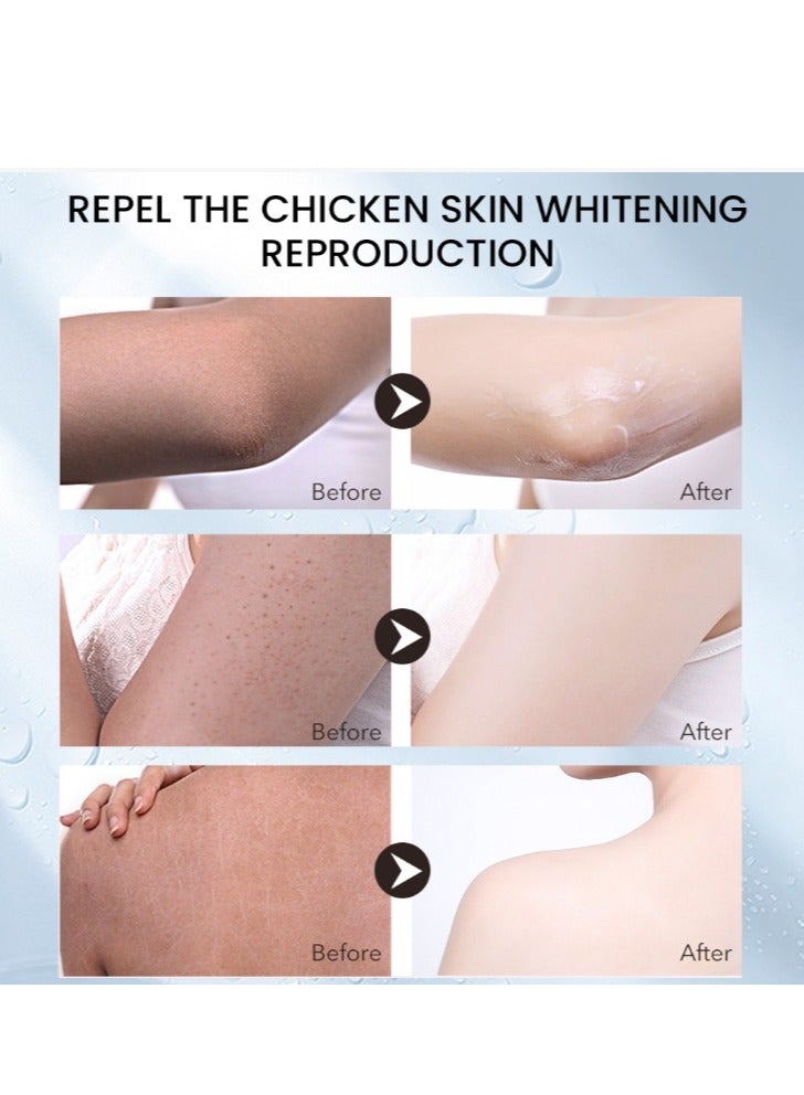 سوميفون لوشن تنظيف التقرن الشعري، مزيل جلد الدجاج، مرطب للبشرة وإصلاح حب الشباب، كريم منعش للجسم، سريع المفعول، استعادة غسول الجسم للاستخدام اليومي والليلي، 30 جم - Image 4