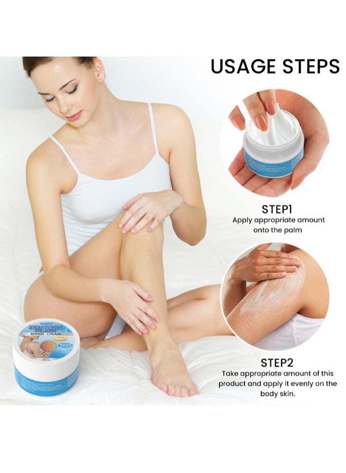 سوميفون لوشن تنظيف التقرن الشعري، مزيل جلد الدجاج، مرطب للبشرة وإصلاح حب الشباب، كريم منعش للجسم، سريع المفعول، استعادة غسول الجسم للاستخدام اليومي والليلي، 30 جم - Image 5