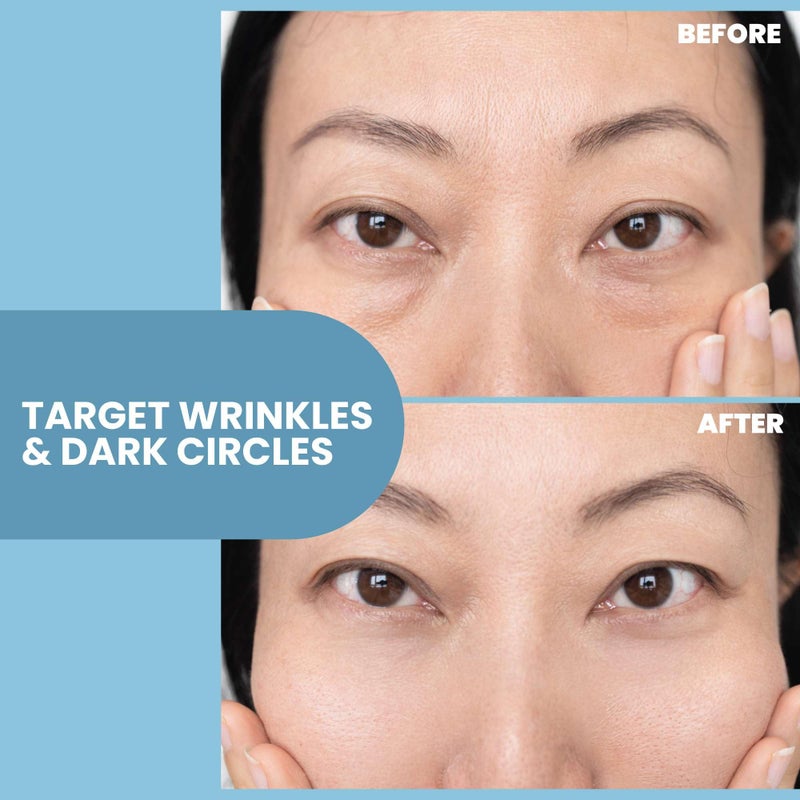 Eva Naturals Eye Gel for Dark Circles, Bags & Puffiness â€“ Anti-Aging Serum with Peptides, Hyaluronic Acid & Botanicals â€“ Firming Under Eye Treatment for Wrinkles, Fine Lines & Tired Skin â€“ 2 oz - Image 4