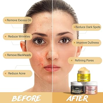 POP MODERN.C Clay Mask Kit Turmeric Vitamin C Clay Mask Dead Sea Mud Mask Himalayan Clay Mask Face Masks Set Skincare for Deep Cleansing Refining Pores Reduce Blackheads Acne Dark Spots Oil Control 3x80g - Image 4