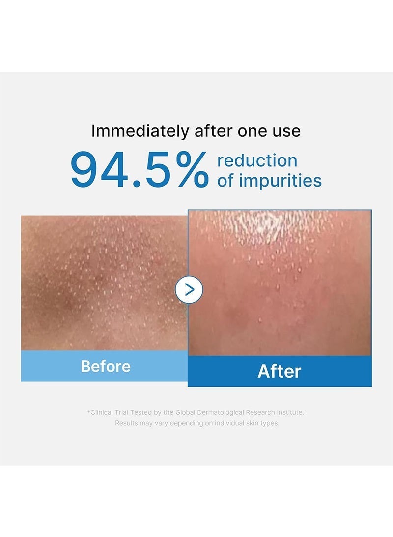 Zero Pore Blackhead Cleansing Oil | Makeup Remover for all skin types, Daily Moisture Facial Cleanser, Low-Irritation(205ml / 6.93 fl.oz) - Image 2