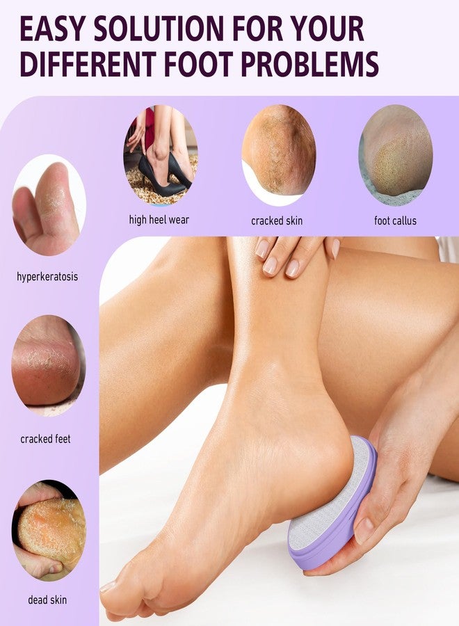 BALUCA Glass Foot File Callus Remover for Feet - Nano Glass Foot Scraper Scrubber Dead Skin Removal for Cracked Heels,Professional Pedicure Tool for Home, Salon, and Travel (Purple) - Image 2