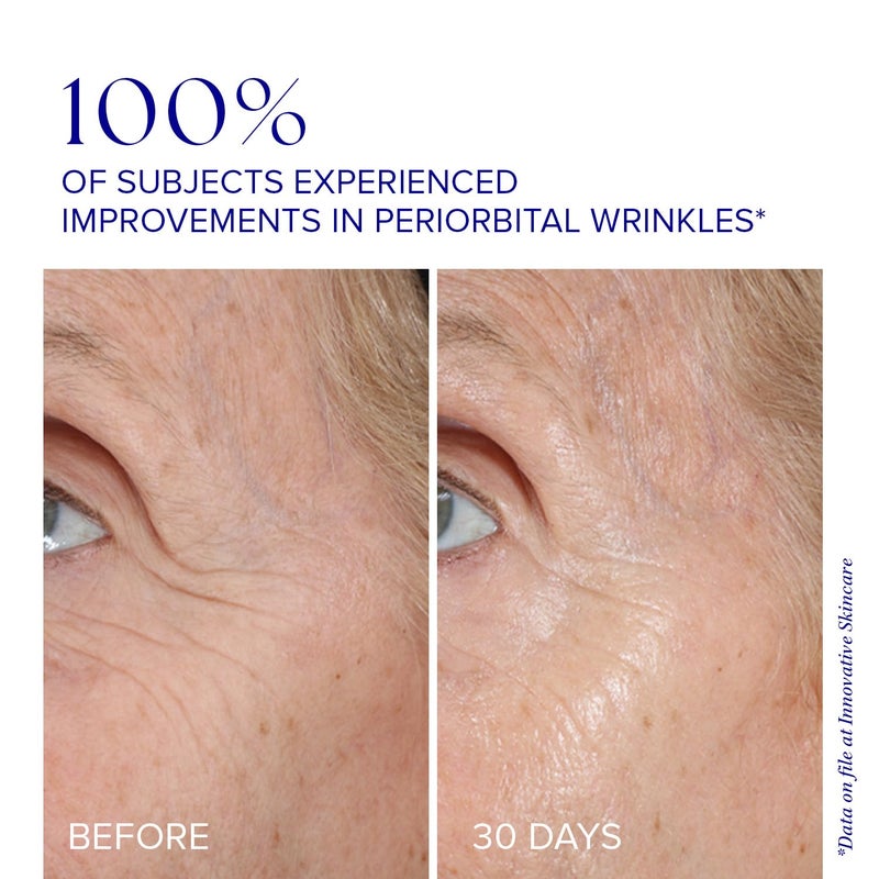 iS CLINICAL Youth Eye Complex, Anti-Aging Brightening Under Eye Cream, Reduces Puffiness, Hydrating and Firming Eye Cream - Image 5