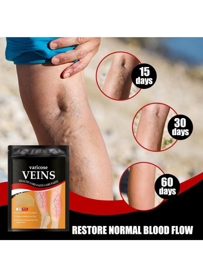 Varicose Vein Patches for Legs, Spider Veins Removal, Varicose Veins Relief Patches, Against Spider Veins, Varicose Veins & Spider Veins Extract Treatment Patches, Vein Relief Herbal Plasters - Image 2