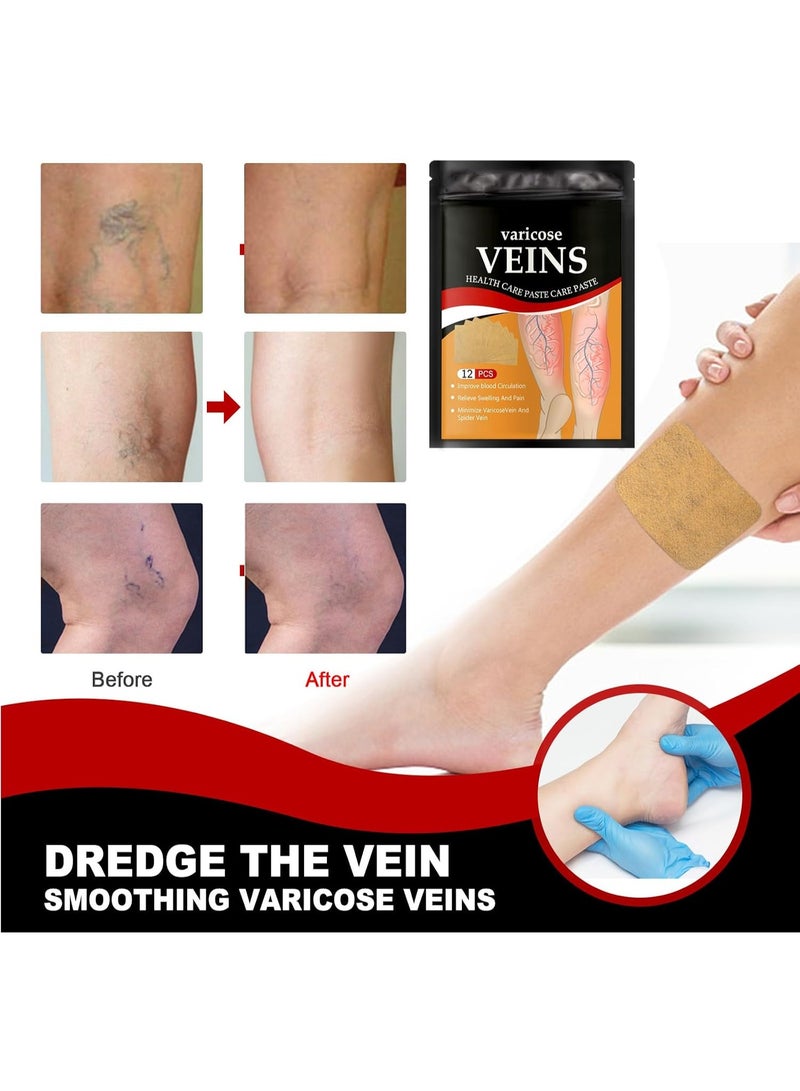 Varicose Vein Patches for Legs, Spider Veins Removal, Varicose Veins Relief Patches, Against Spider Veins, Varicose Veins & Spider Veins Extract Treatment Patches, Vein Relief Herbal Plasters - Image 5