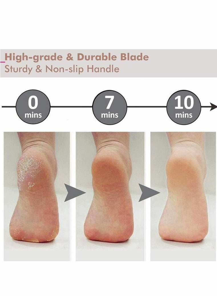 Stainless Steel Colossal Foot Rasp, Foot File Callus Remover Foot Scrapper Foot Scrubber For Professional PedicureforDead Skin ed Skin Corns Removal Foot Care Pedicure Tools - Image 3