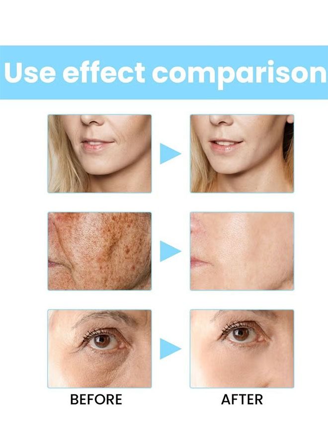 EELHOE Sea Grape Facial Serum 30ml,Reduce Wrinkles And Fine Lines, Improve Skin Elasticity And Softness, Fade Freckles And Dark Spots, Replenish Moisture, Shrink Pores, Suitable For All Skin Types. - Image 5