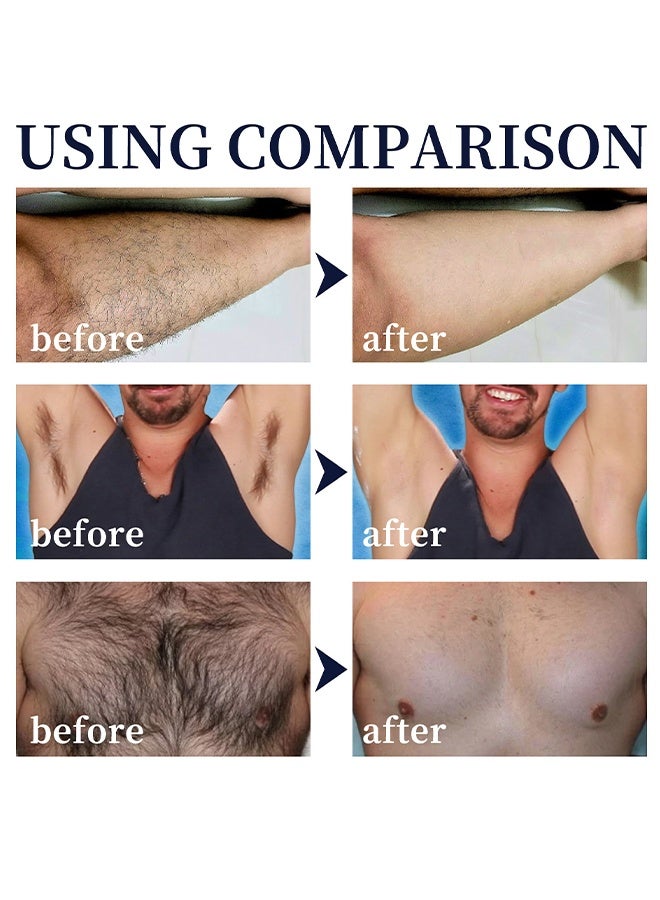 East Moon Hair Removal Spray Foam - Specially Formulated For Men, Painless Hair Removal Spray Armpit Gentle Hair Remover Refreshing Quick Hair Removal Spray, Safe Hair Depilatory For Male Underarm, Chest, Back, Legs - Image 4