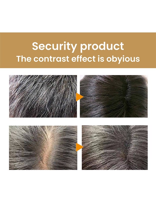 Ginger Hand Made Ginger Resh Plant Shampoo Bar-Ginger Hair Regrowth Shampoo Bar,No Silicone Oil,Natural Ginger Shampoo Soap Bar for Hair Growth, Ginger Regrowth Hair - Image 3