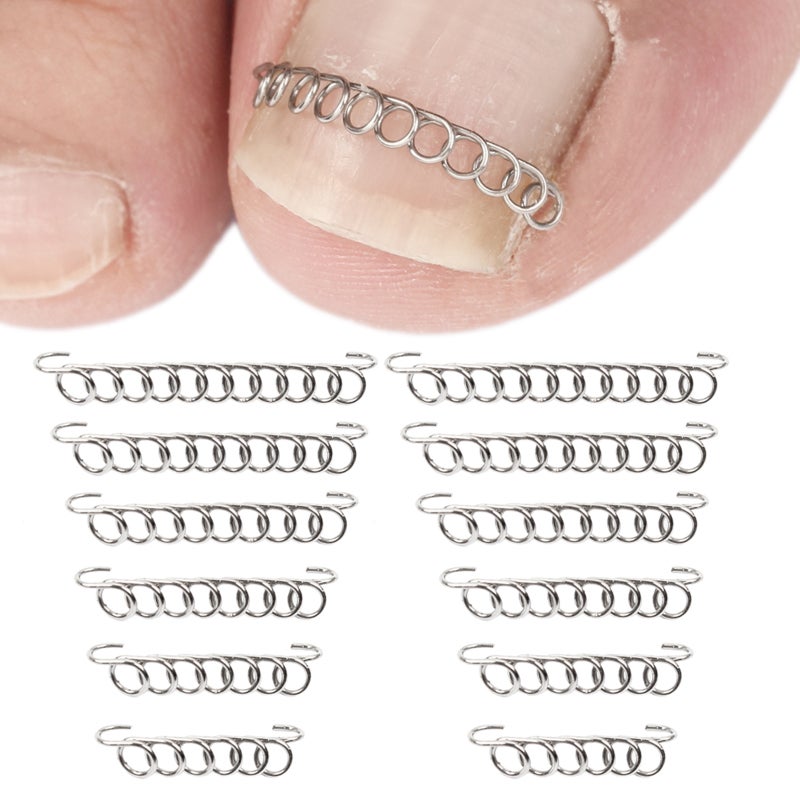 Ingrown Toenail Lifter: Stainless Steel, Sturdy Durable, Safe Painless - Multicolor Toenail Spring Kit for Foot Care Pedicure Maintenance - Image 3