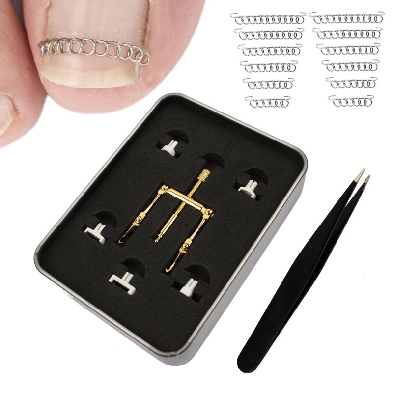 Ingrown Toenail Lifter: Stainless Steel, Sturdy Durable, Safe Painless - Multicolor Toenail Spring Kit for Foot Care Pedicure Maintenance - Image 4