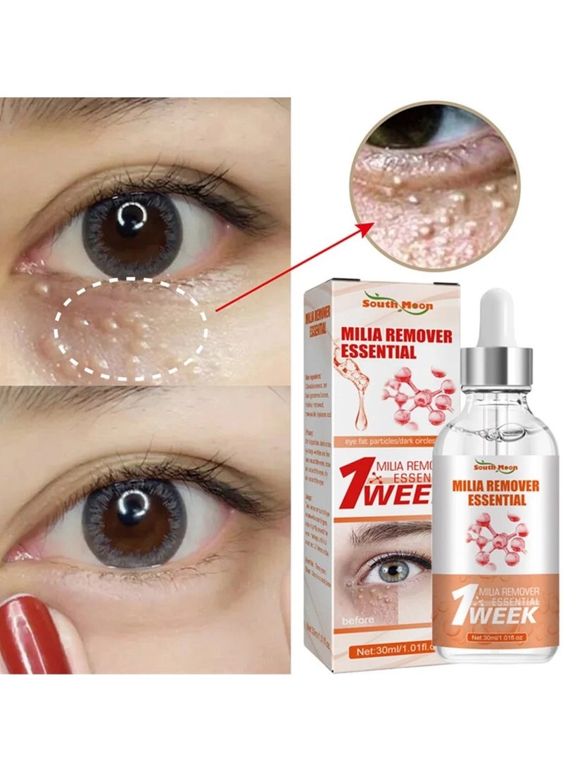 SOUTH MOON Fast Milia Remover, Milia Spot Treatment for Eye, Milia Remover Essential, Removes Fat Particles Under the Eyes, Tightens and Firms the Eye Area and Reduces Fine Lines  - Image 4
