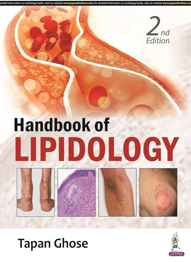 Handbook of Lipidology  - Image 1