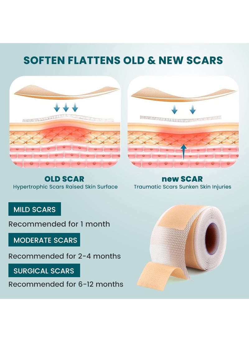 Sumifun Wound Repair Scar Patch, Surgical Scar Removal Patch, Sports Trauma Scar Care Patch(2*100cm)  - Image 3