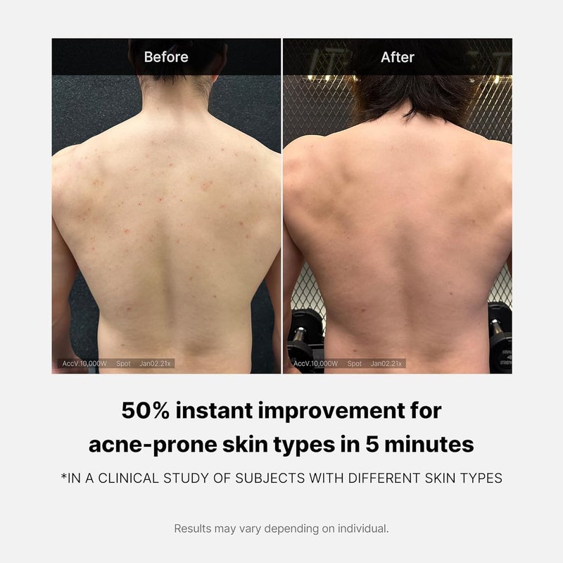 Medicube Red Acne Body Wash (400g), Exfoliating Body Cleanser for Acne Prone Skin, Deep Cleansing & Dead Skin Removal Body Wash for Clear Smooth Skin, Daily Use Formula for Back & Body Breakouts - Image 5