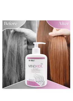 Dr. Max MINOXIDIL 5% Hair Growth Innovative Hair Shampoo  - Image 3