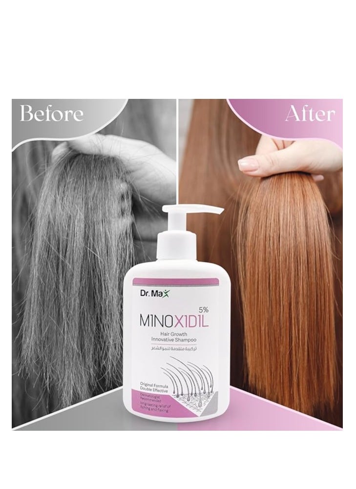 Dr. Max - MINOXIDIL 5% Hair Growth Innovative Hair Shampoo - Image 1