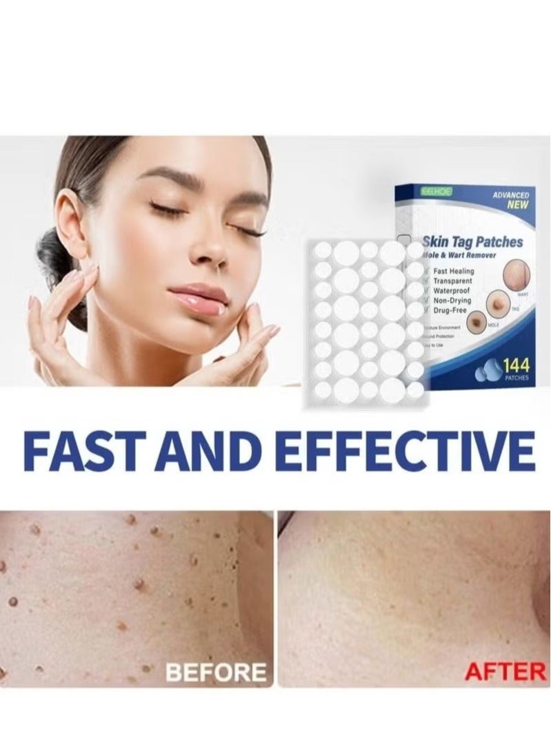 EELHOE 144pcs/box Wart Removal Patches Mole Warts Removal Sticker Natural Ingredients Skin Tag Remover Stickers  - Image 3