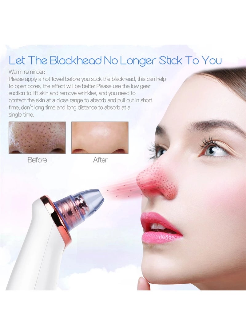 CkeyiN Suction Blackhead Remover Whitehead Remover Electric Facial Extractor with 5 Probes USB Rechargeable Vacuum Pore Cleaner Facial Skin Care Beauty Device MU007 - Image 4