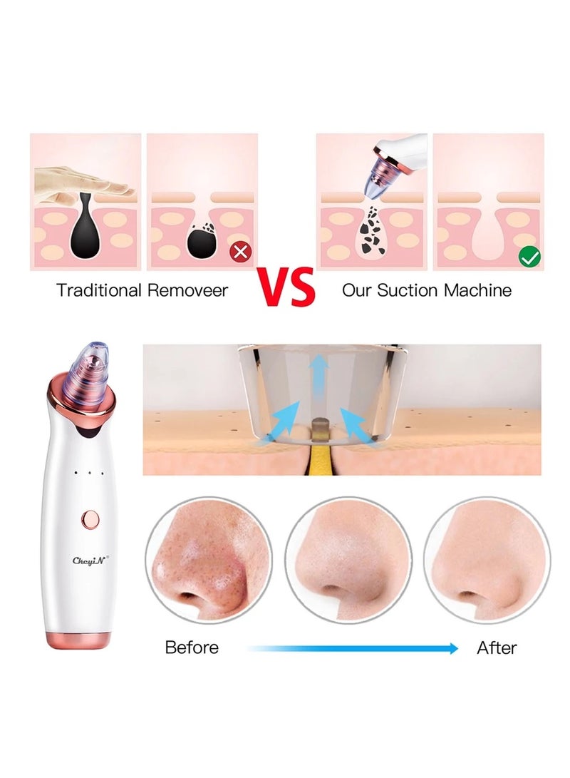 CkeyiN Suction Blackhead Remover Whitehead Remover Electric Facial Extractor with 5 Probes USB Rechargeable Vacuum Pore Cleaner Facial Skin Care Beauty Device MU007 - Image 3