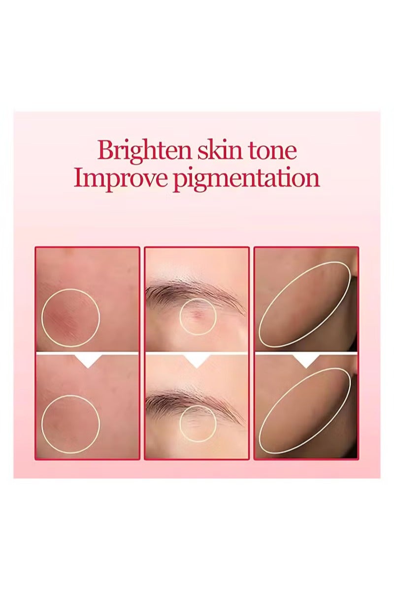 Nouelv 10% Niacinamide Serum + 4% Tranexamic Acid Serum – Brightening & Dark Spot Corrector | Pore Minimizer & Oil Control | Niacinamide for Hyperpigmentation & Even Skin Tone (30mL / 1.01 fl.oz.) - Image 2