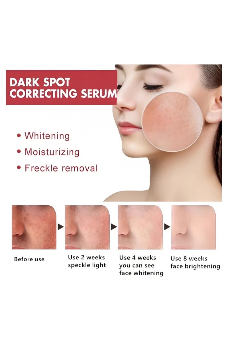 Nouelv 10% Niacinamide Serum + 4% Tranexamic Acid Serum – Brightening & Dark Spot Corrector | Pore Minimizer & Oil Control | Niacinamide for Hyperpigmentation & Even Skin Tone (30mL / 1.01 fl.oz.) - Image 3