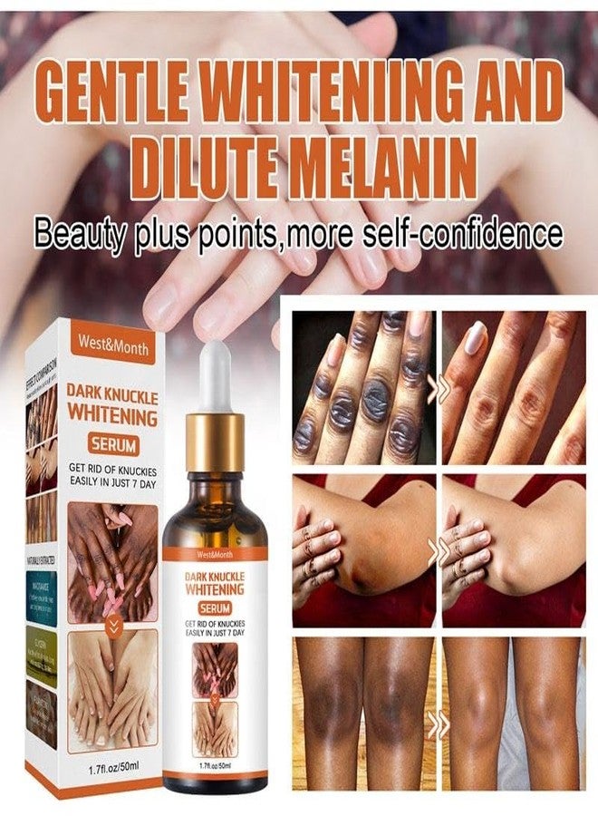ZeroLuxury® Dark Knuckles: Whitening Serum for Radiant Skin Whitening & Skin Lightening Serum for All Skin Types For Women And Men-30ML - Image 2