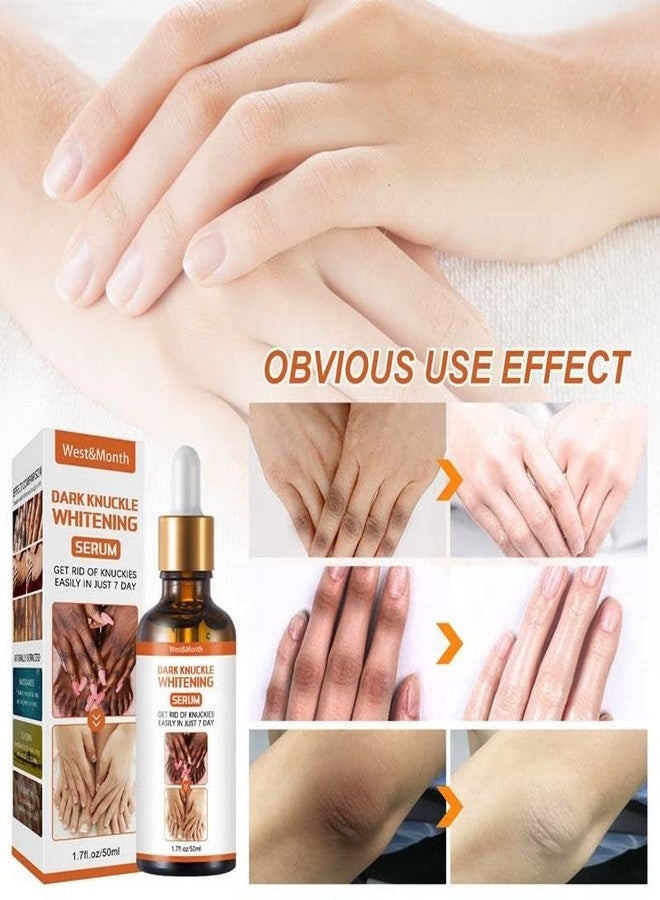 ZeroLuxury® Dark Knuckles: Whitening Serum for Radiant Skin Whitening & Skin Lightening Serum for All Skin Types For Women And Men-30ML - Image 5