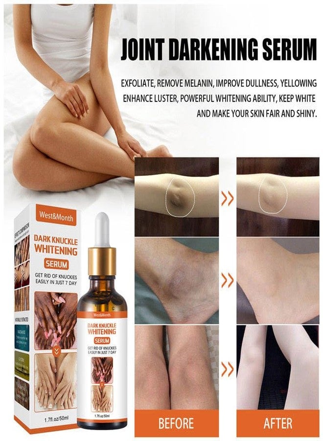 ZeroLuxury® Dark Knuckles: Whitening Serum for Radiant Skin Whitening & Skin Lightening Serum for All Skin Types For Women And Men-30ML - Image 3