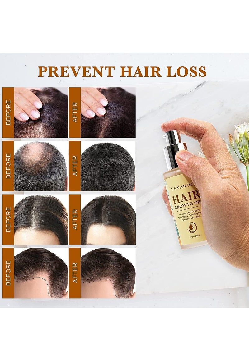 ڤينانوتشي زيت البيوتين وزيت الخروع وزيت إكليل الجبل لنمو الشعر للنساء، علاجات تساقط الشعر، زيت الشعر الجاف، من فينانوسي - Image 2