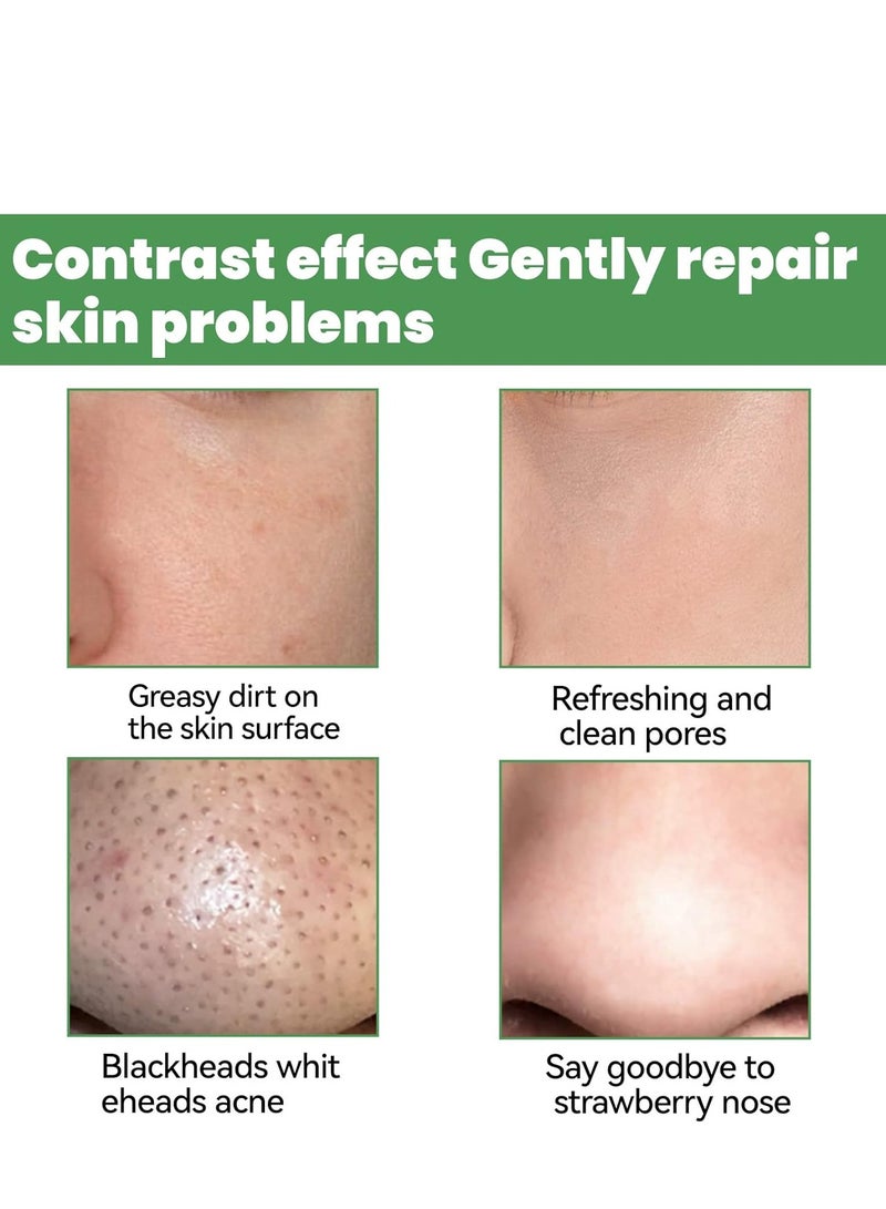 إيلهو قناع فقاعة الأكسجين ، 1.76 أونصة ، يحسن الرؤوس السوداء بلطف للحصول على بشرة أكثر نقاء - Image 5