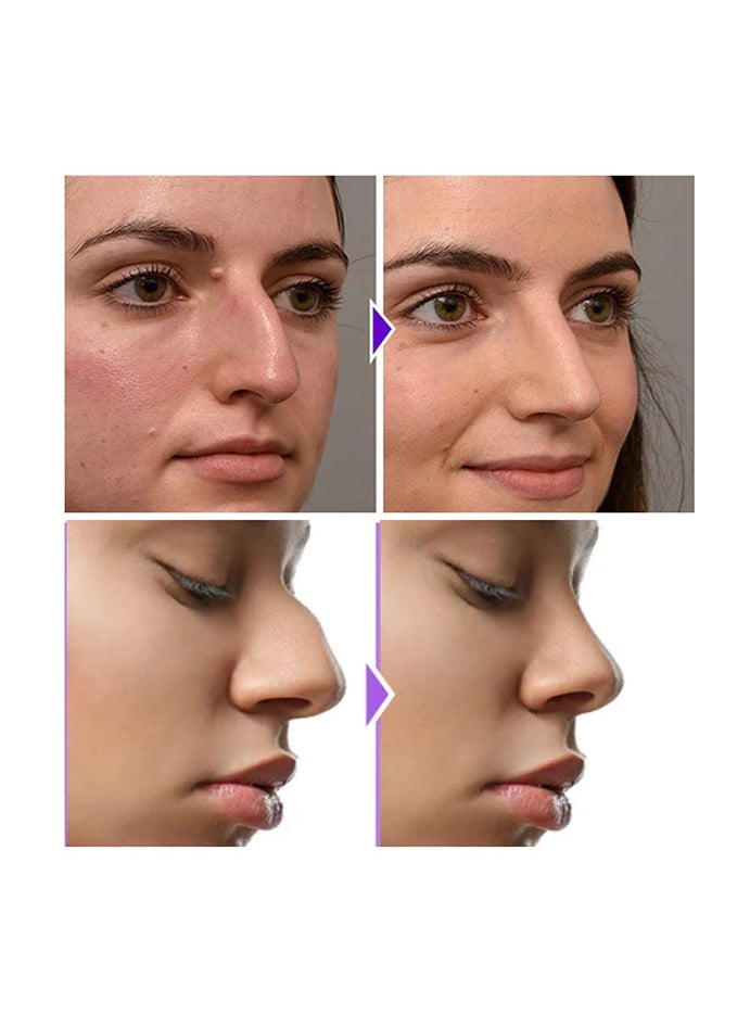 Generic - Noselift Nose Sculpfing Device,  Takes On Loose Cartilage and Skin On The Nose's Tip, Giving You a Firmer and More Youthful Appearance, Comfortable and User-Friendly - Image 1