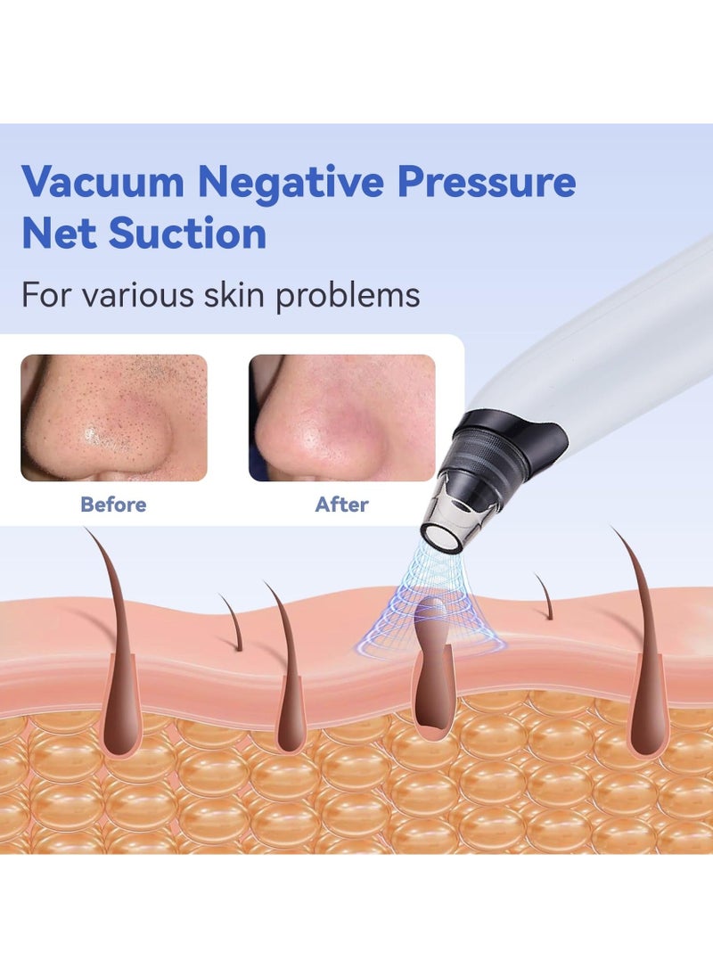 Generic Blackhead Remover Pore Vacuum, Face Vacuum Pore Cleanser, Electric Acne Comedone Whitehead Remover Tools 4 Suction Power with LED Display, Rechargeable Pimple Popper Tool Kit  - Image 2