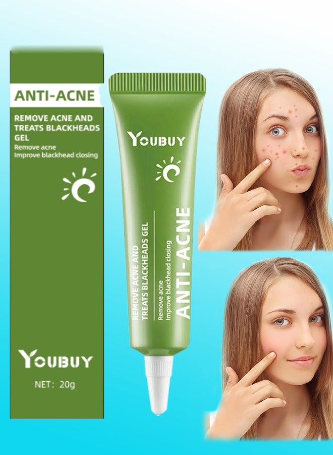 YOUBUY Anti Acne Remove Acne and Treats Blackheads Gel for Day Use Remove Acne Pimple and Treats Blackhead with Azelaic Acid Oil Control Shrink Pores Redness Relief Skin Lightening Scar Fade Cream Acne Remover Cream 20g - Image 1